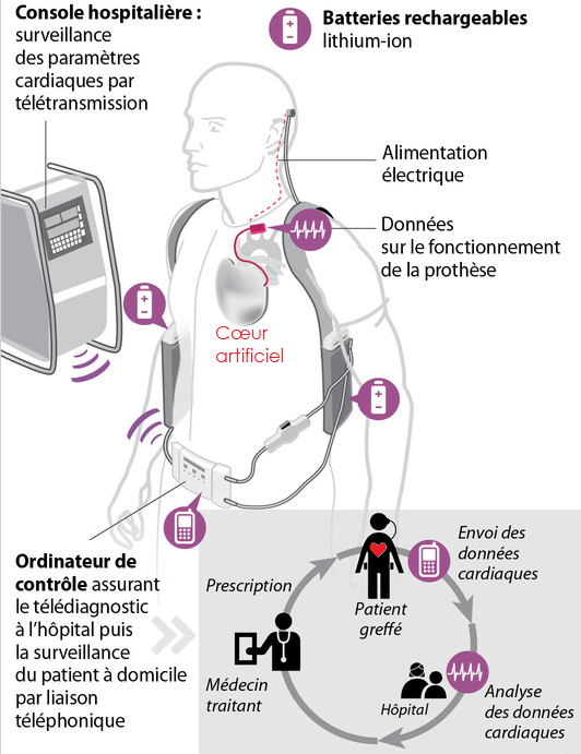 Schéma du fonctionnement des batteries