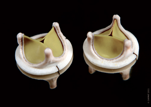 Valves bio-synthétique du cœur CARMAT