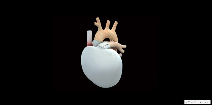 Coeur artificiel CARMAT vu de face